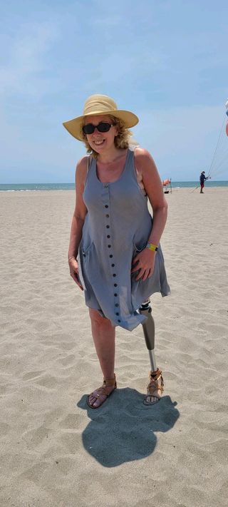 Female at beach with leg prosthetic