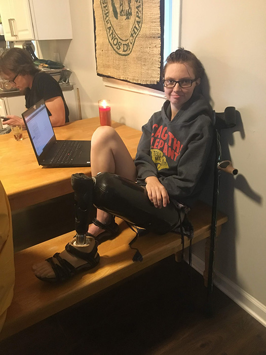 Female at kitchen table with leg prosthetic