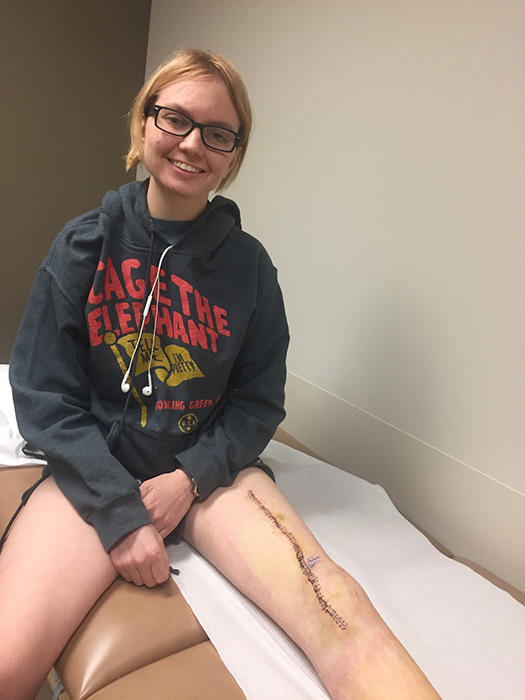 Patient at doctor visit after limb salvage surgery