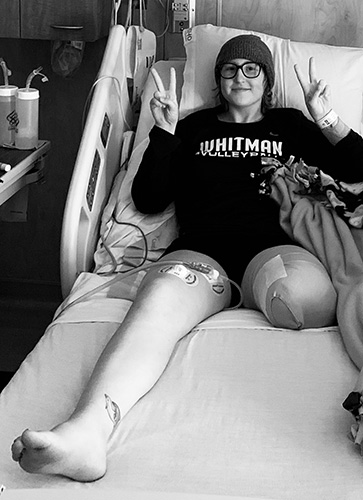 Black and white image of leg amputation patient laying in hospital beg holding up peace signs.