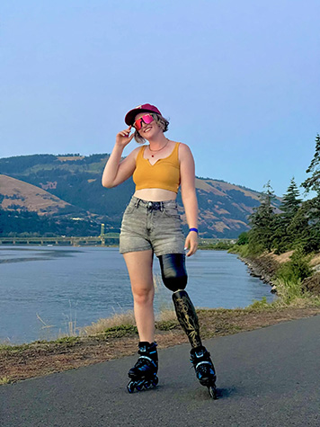 Female with leg prosthetic wearing skates by a river