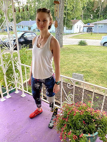 Female with blade leg prosthetic standing on porch