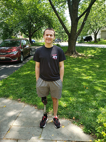 Male with leg prosthetic stands in the shade of a tree