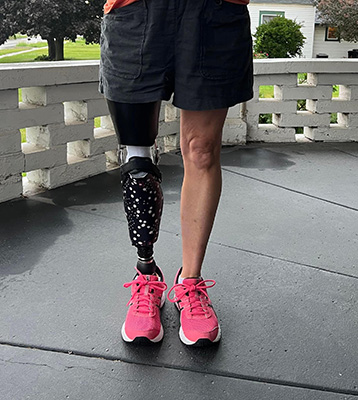 Individual stands on porch with leg prosthetic