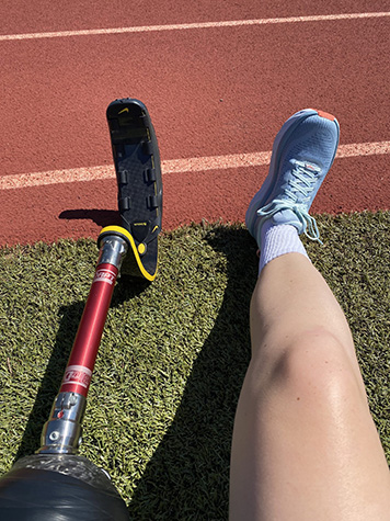Athlete with blade leg prosthetic sitting on side of track