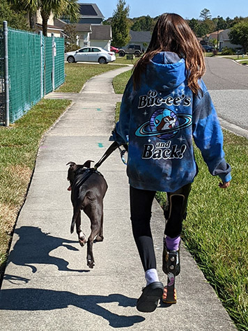 Female with leg prosthetic walking dog down a sidewalk